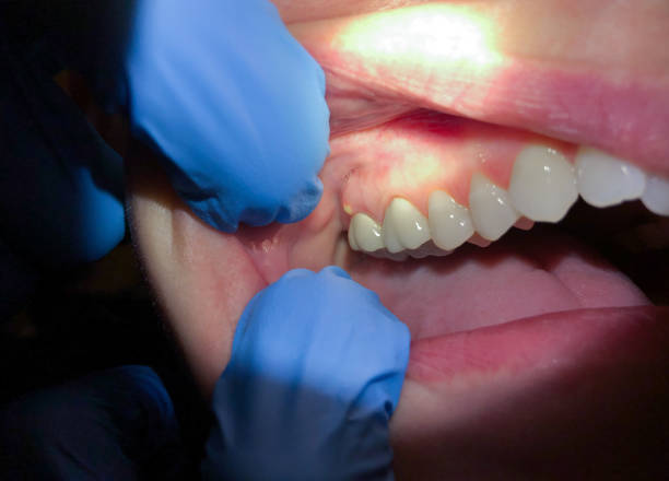 Best Emergency Dental Care for Sports Injuries in Hasley Nyon, CA